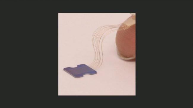 neuralink 3 threads jpg