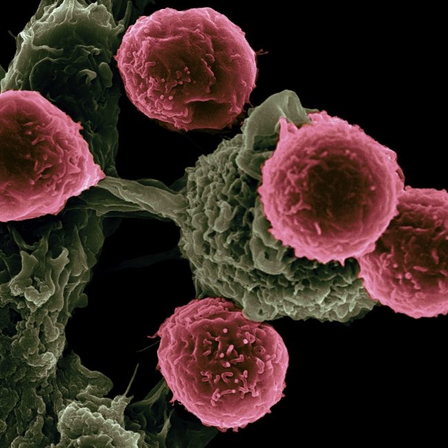 cancer cells bunky rakovina zdravi (unsplash.com)