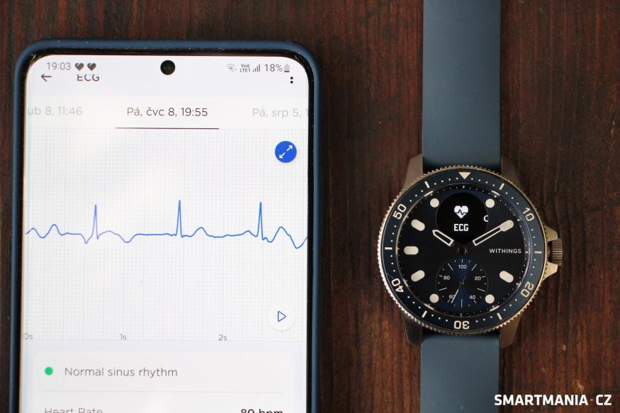 Withings scanwatch horizon 34