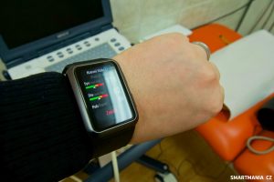 Huawei Watch D clanek 3