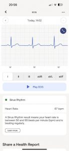 Naměřené hodnoty EKG si dokonce můžete zpětně „přehrát“
