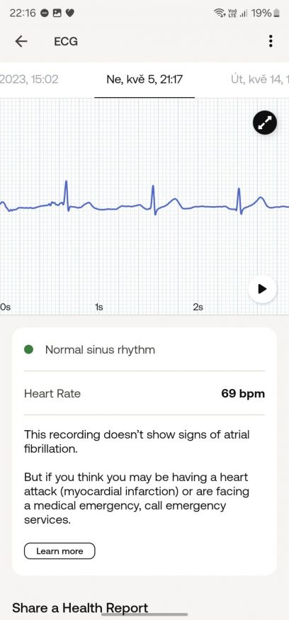 Měření EKG