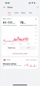 Chytré hodinky Huawei Watch Fit 4