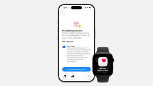 Apple Watch Series 11