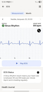 Výsledky měření EKG v aplikaci Withings