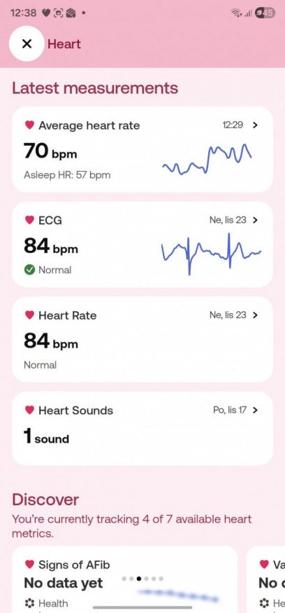 Měření v aplikaci BeamO - srdce