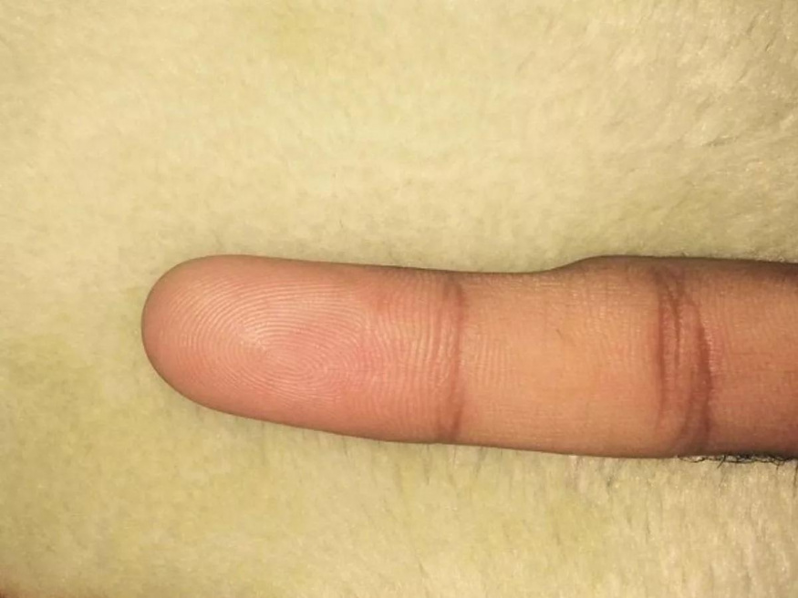 Smartphonový malíček