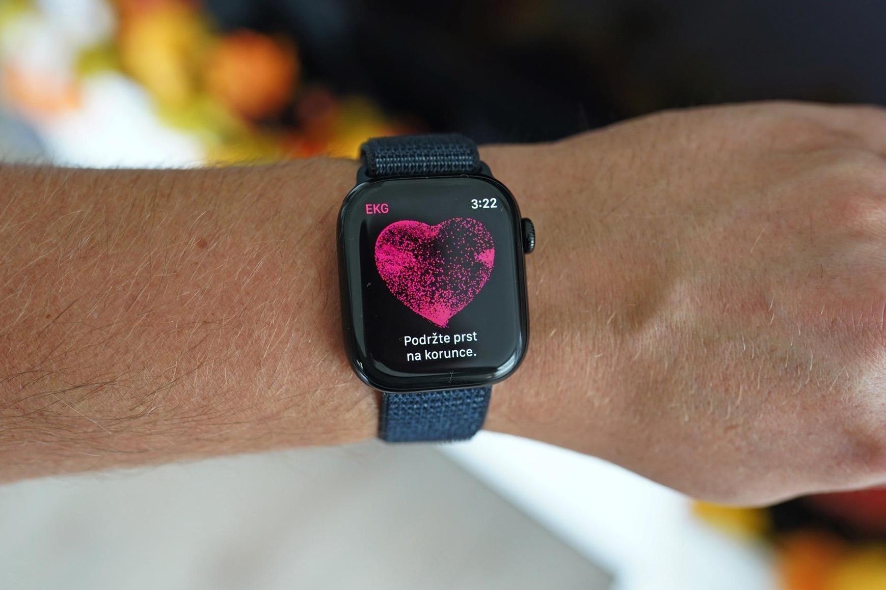 Chytré hodinky Apple Watch Series 10