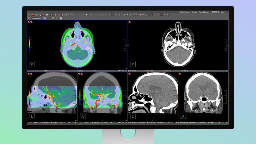 Studio Display XDR využívaný pro zobrazení radiologických snímků Studio Display XDR využívaný pro zobrazení radiologických snímků